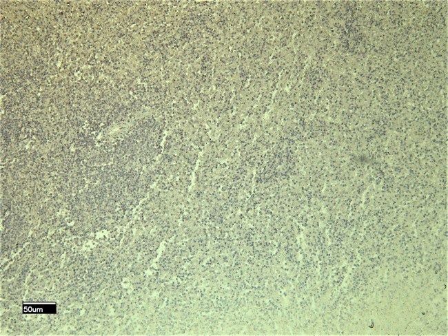 CXCR3 Antibody in Immunohistochemistry (Paraffin) (IHC (P))