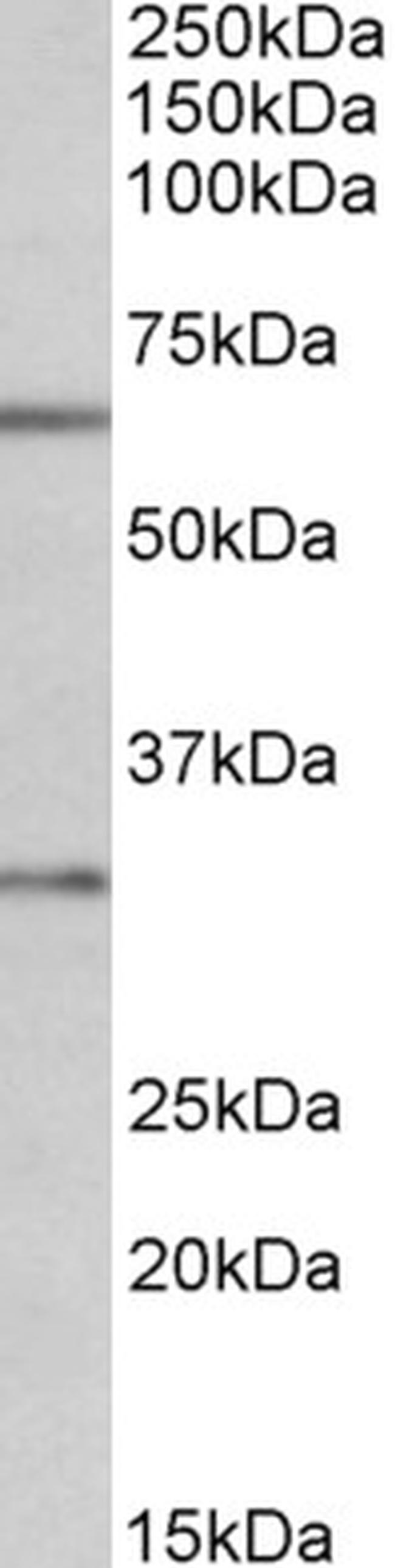 Caspase 3 Antibody in Western Blot (WB)