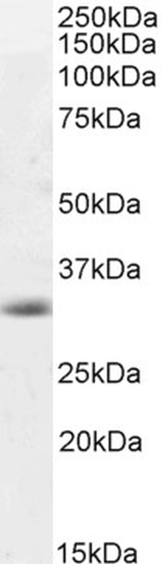 Caspase 3 Antibody in Western Blot (WB)