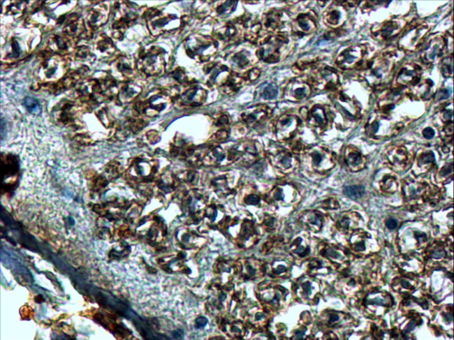 SLIT2 Antibody in Immunohistochemistry (Paraffin) (IHC (P))