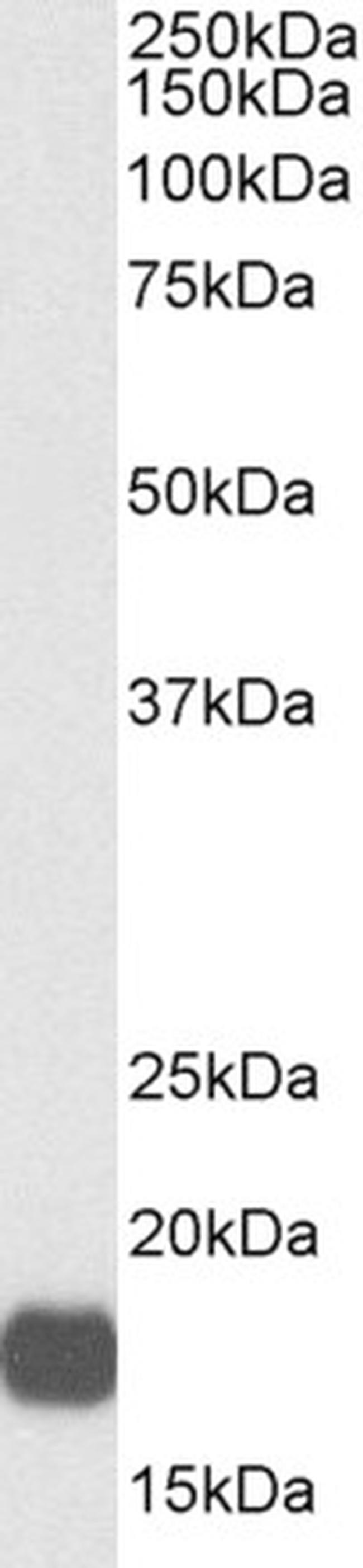 VHL Antibody in Western Blot (WB)