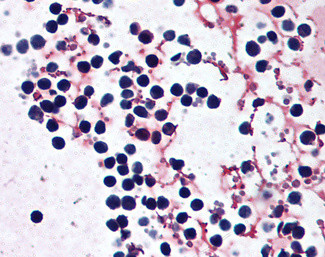 NLRP3 Antibody in Immunohistochemistry (Paraffin) (IHC (P))