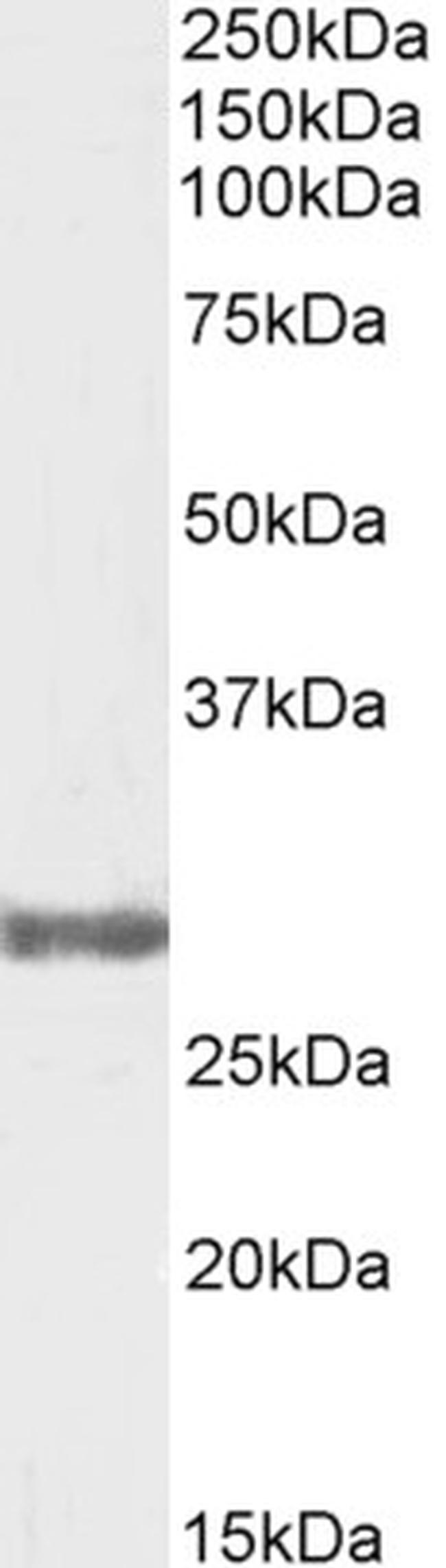 COMT Antibody in Western Blot (WB)