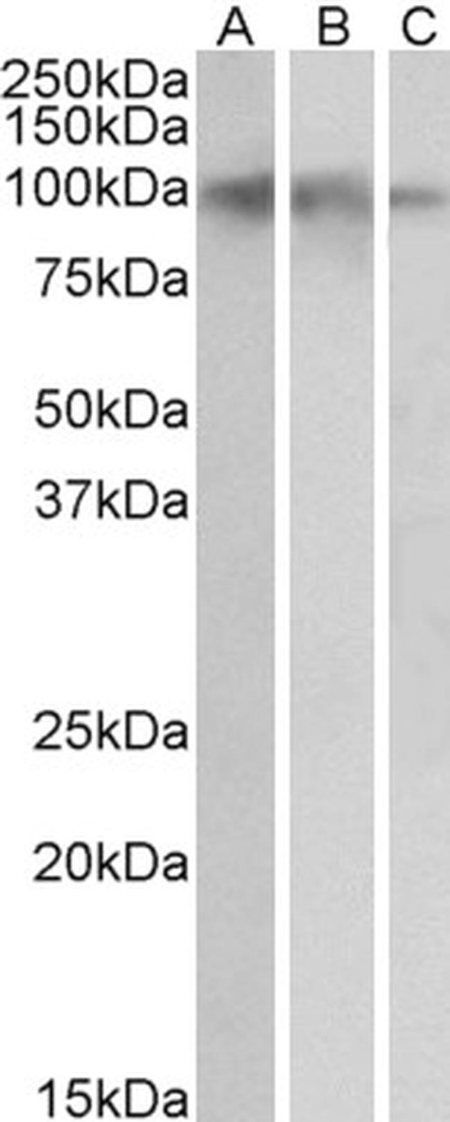 TrkB Antibody in Western Blot (WB)