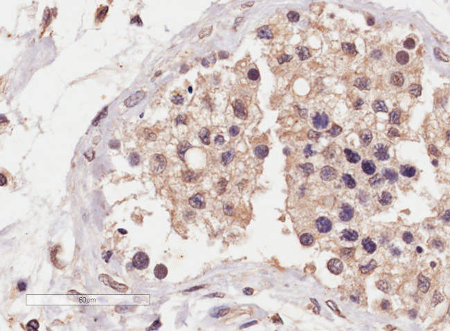 SLC22A16 Antibody in Immunohistochemistry (Paraffin) (IHC (P))
