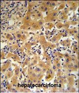 Ceruloplasmin Antibody in Immunohistochemistry (Paraffin) (IHC (P))