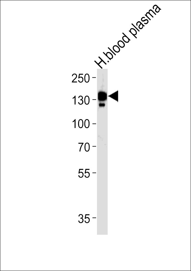 Ceruloplasmin Antibody in Western Blot (WB)