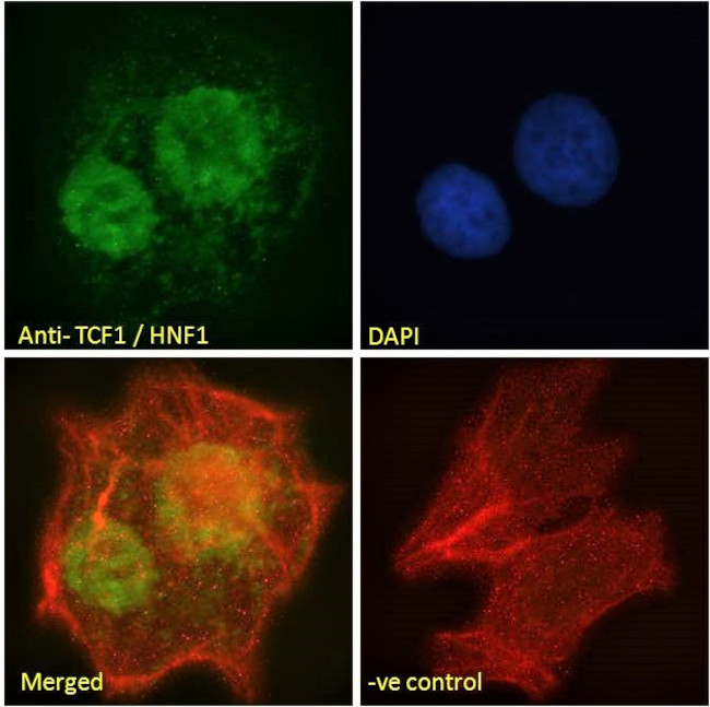 HNF1A Antibody in Immunocytochemistry (ICC/IF)