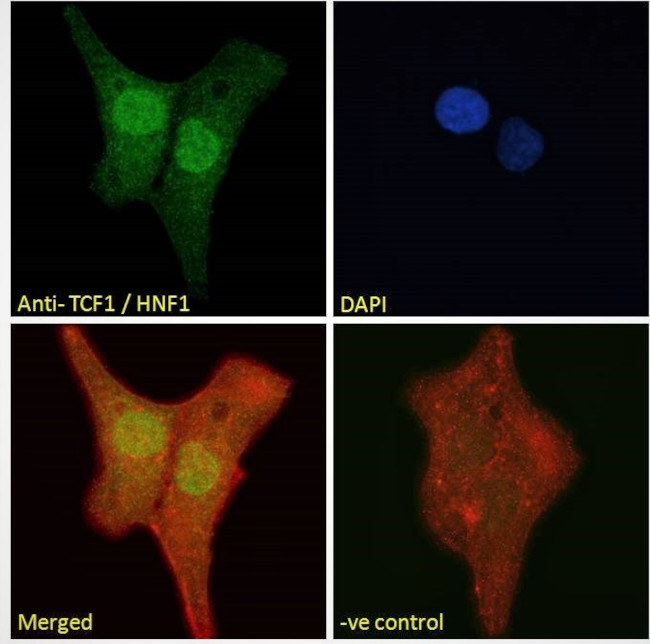 HNF1A Antibody in Immunocytochemistry (ICC/IF)