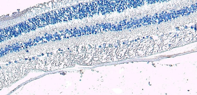 ARR3 Antibody in Immunohistochemistry (Paraffin) (IHC (P))