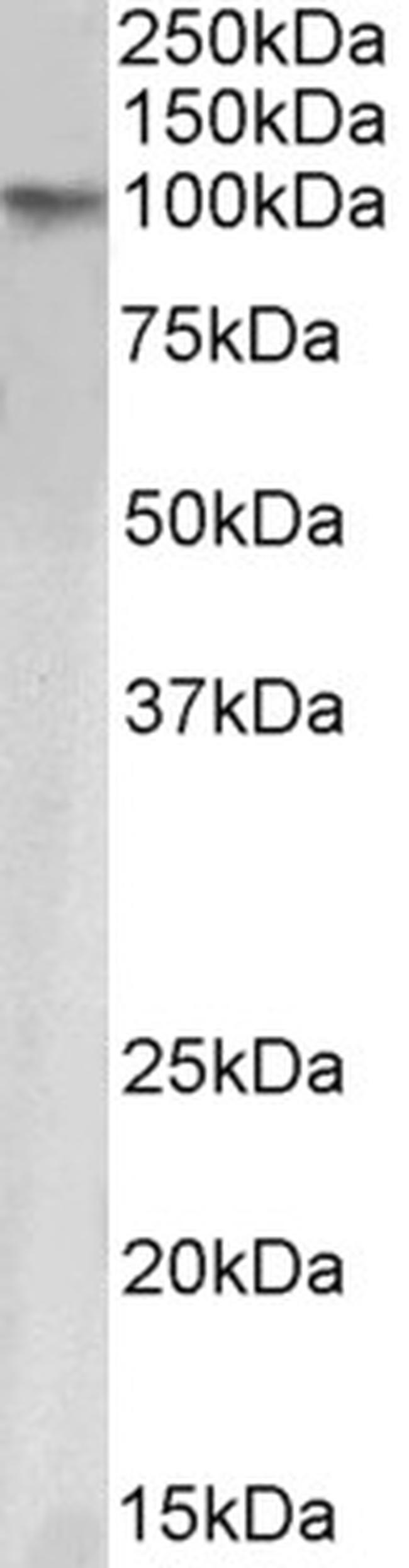 TRIM28 Antibody in Western Blot (WB)