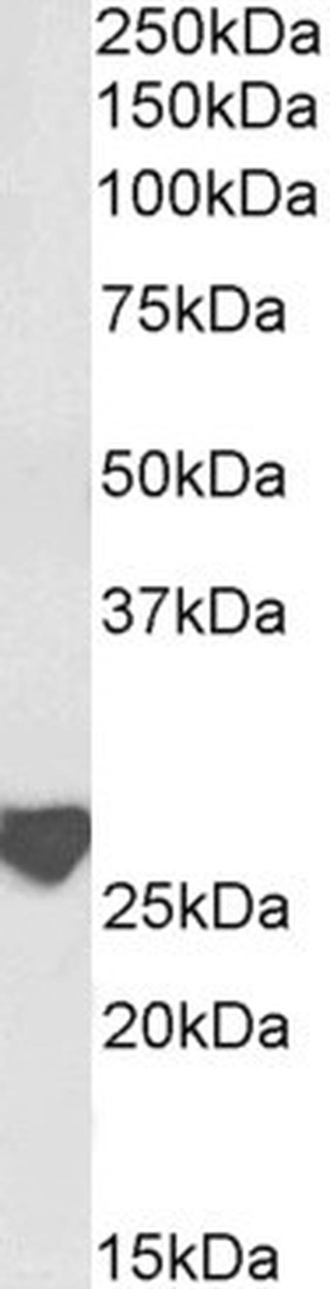 Latexin Antibody in Western Blot (WB)