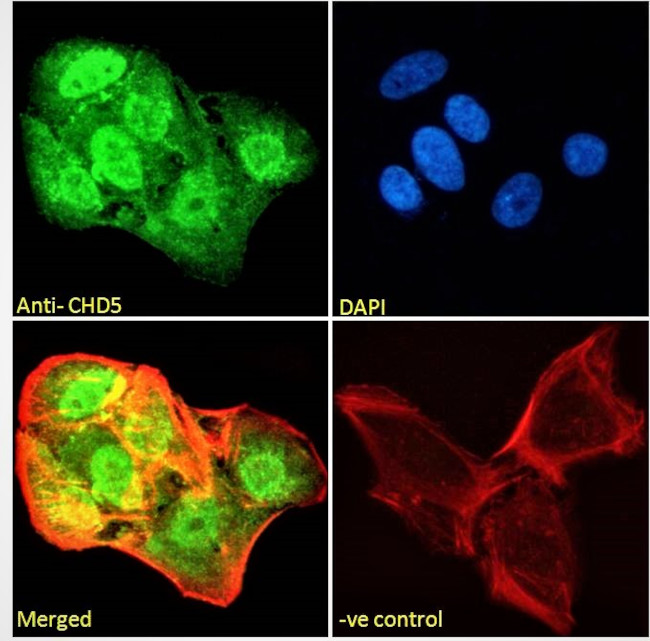 CHD5 Antibody in Immunocytochemistry (ICC/IF)