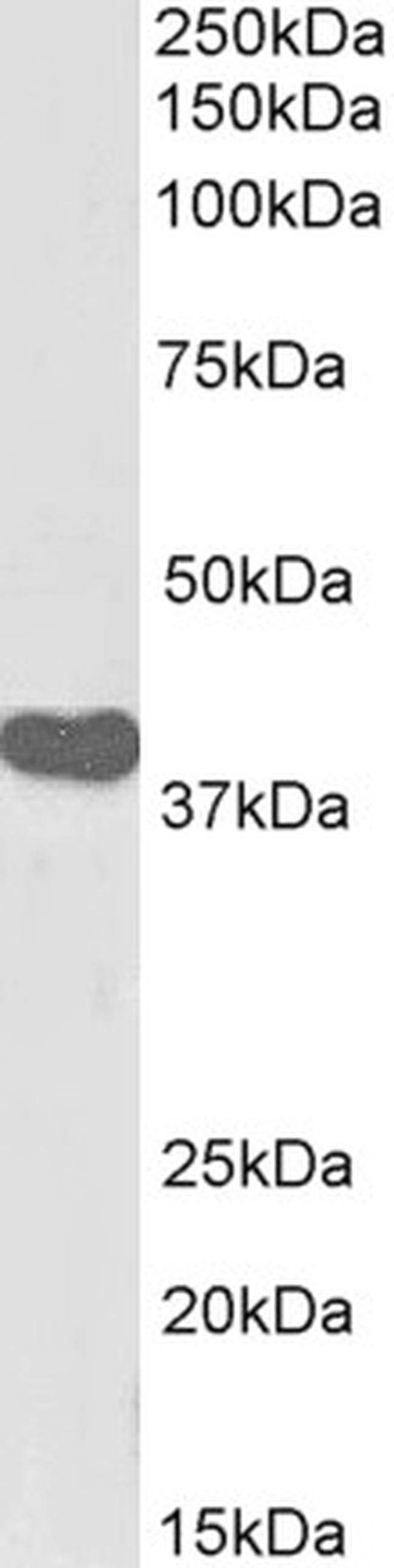 ILF2 Antibody in Western Blot (WB)