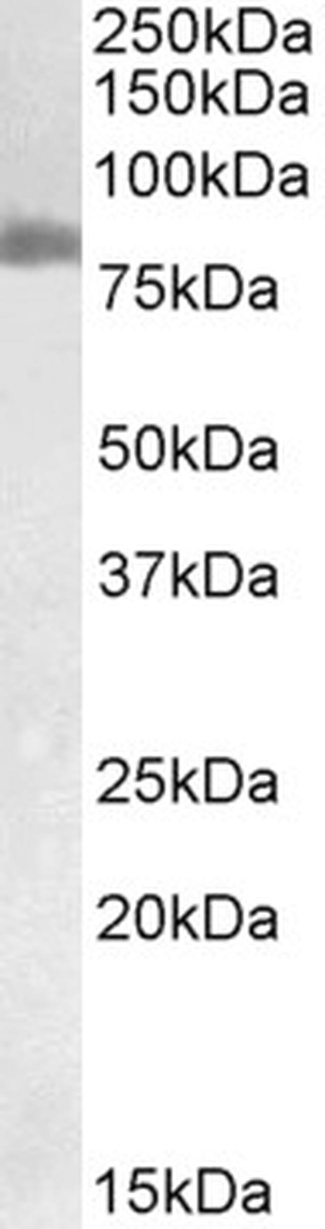 TGM2 Antibody in Western Blot (WB)