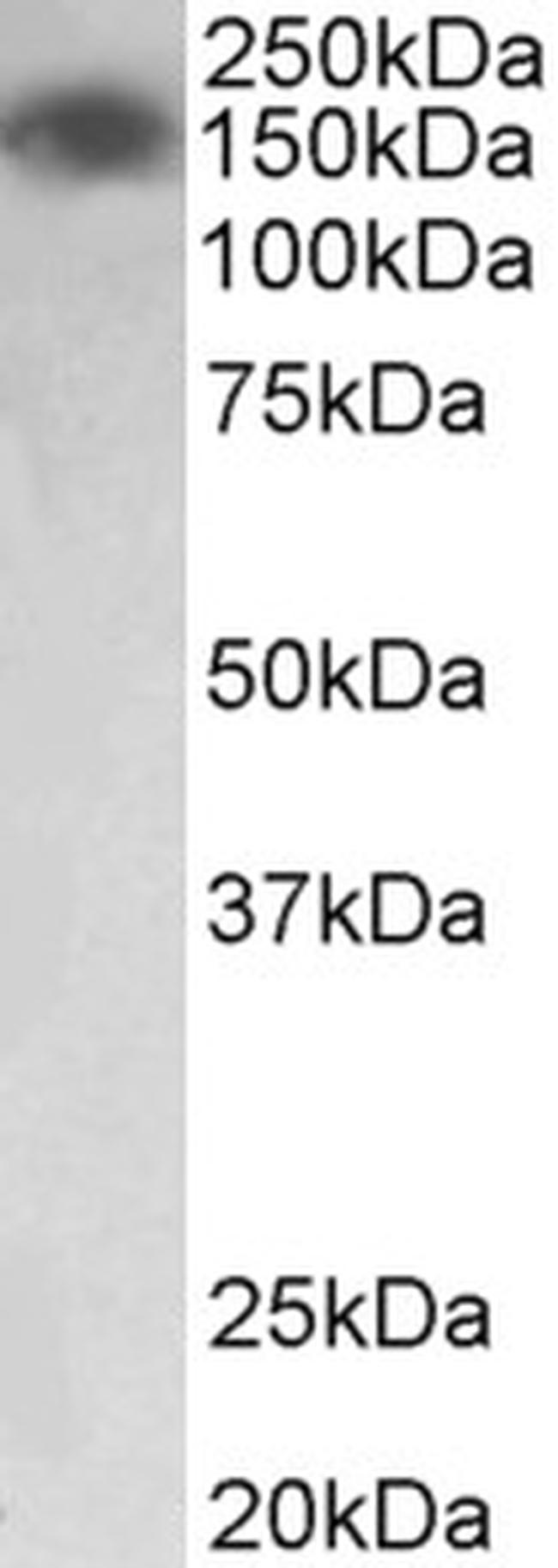 MYLK Antibody in Western Blot (WB)