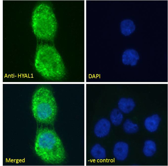 HYAL1 Antibody in Immunocytochemistry (ICC/IF)