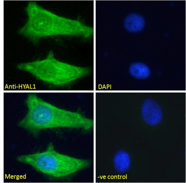 HYAL1 Antibody in Immunocytochemistry (ICC/IF)