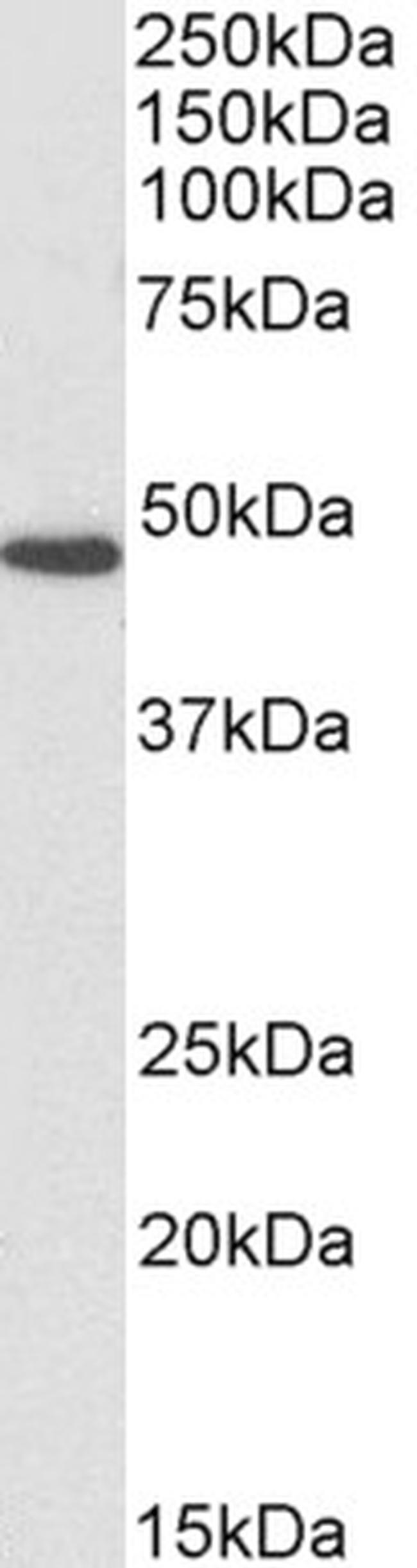 Fumarase Antibody in Western Blot (WB)