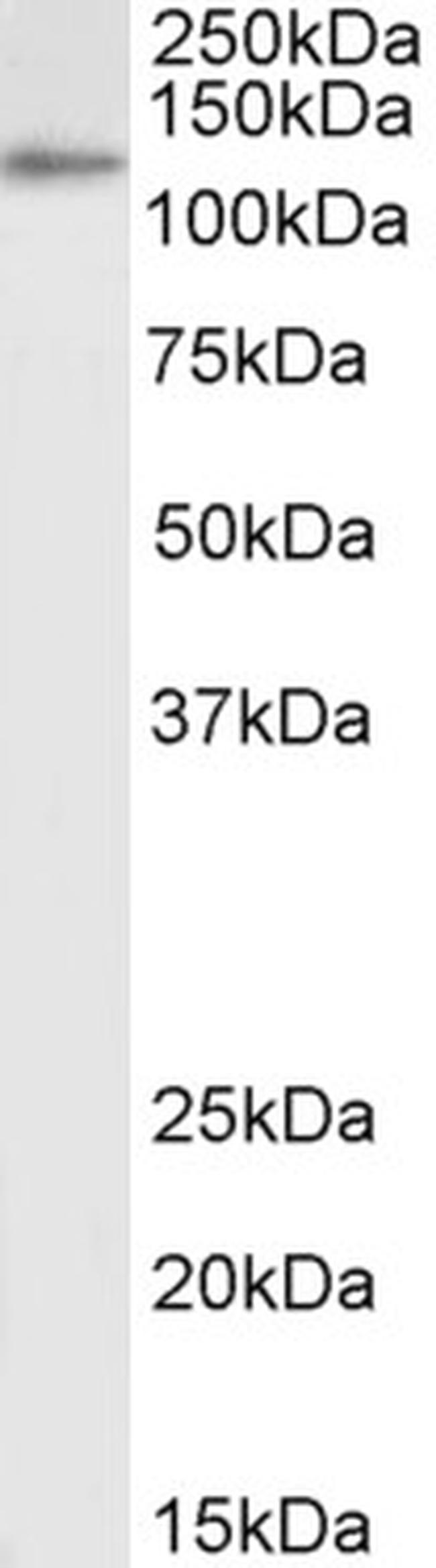 IDE Antibody in Western Blot (WB)