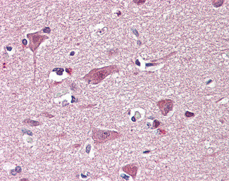 CHD7 Antibody in Immunohistochemistry (Paraffin) (IHC (P))