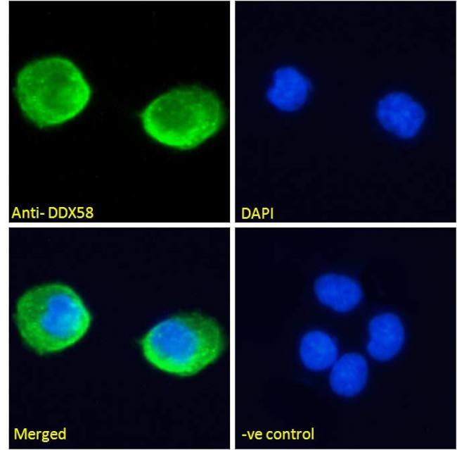 RIG-I Antibody in Immunocytochemistry (ICC/IF)