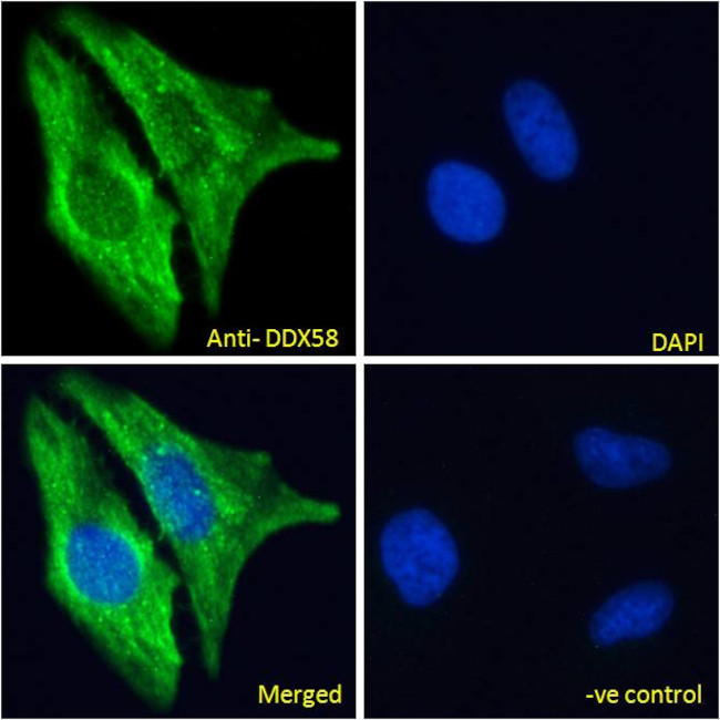 RIG-I Antibody in Immunocytochemistry (ICC/IF)