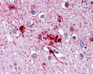 RIG-I Antibody in Immunohistochemistry (Paraffin) (IHC (P))