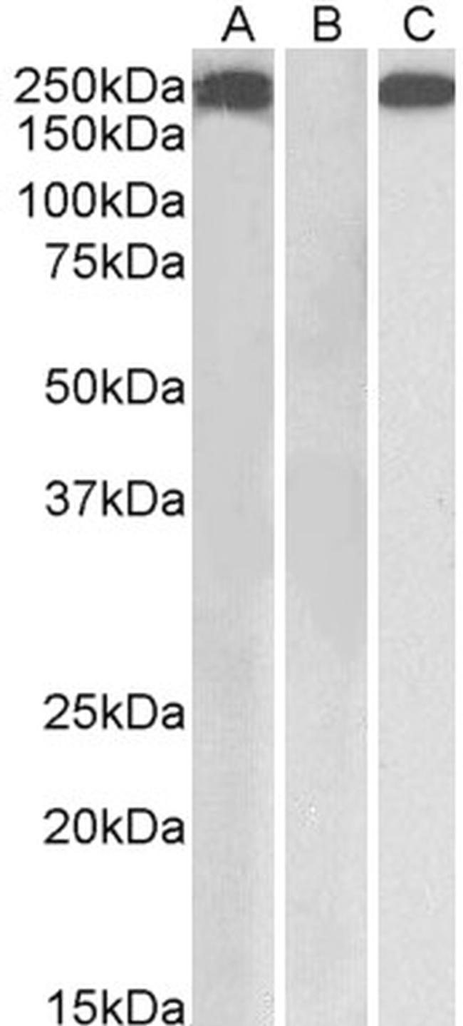 Thrombospondin 1 Antibody in Western Blot (WB)