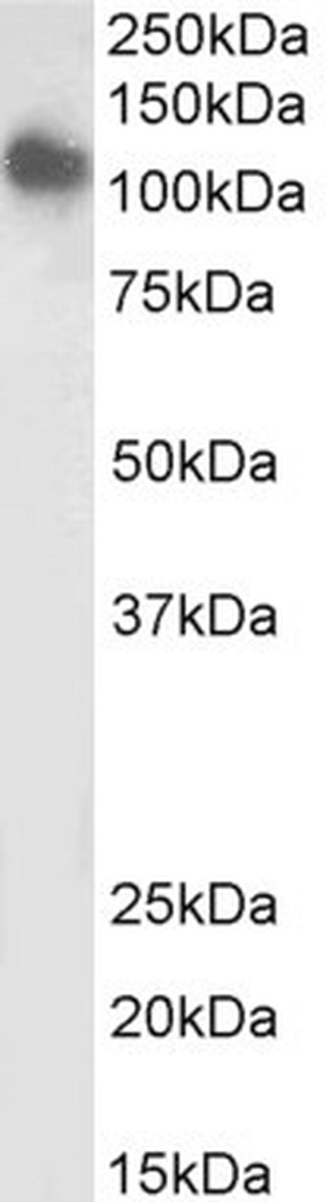 SLC12A6 Antibody in Western Blot (WB)