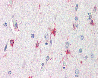 BAG3 Antibody in Immunohistochemistry (Paraffin) (IHC (P))