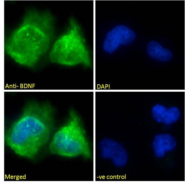 BDNF Antibody in Immunocytochemistry (ICC/IF)