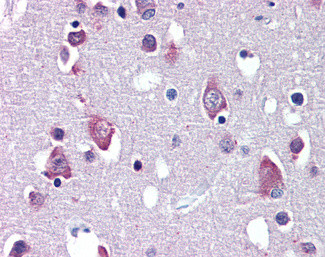 BDNF Antibody in Immunohistochemistry (Paraffin) (IHC (P))