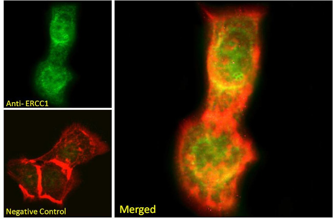 ERCC1 Antibody in Immunocytochemistry (ICC/IF)