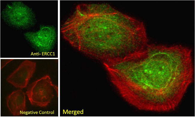 ERCC1 Antibody in Immunocytochemistry (ICC/IF)