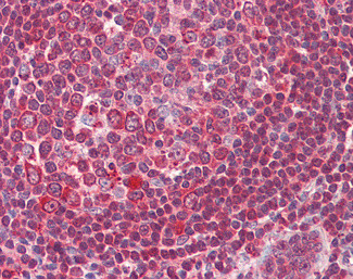 ERCC1 Antibody in Immunohistochemistry (Paraffin) (IHC (P))