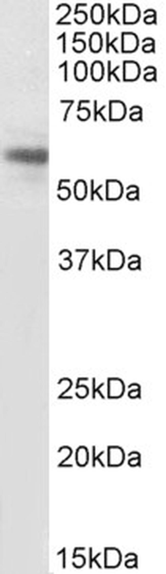 ACVR1 Antibody in Western Blot (WB)