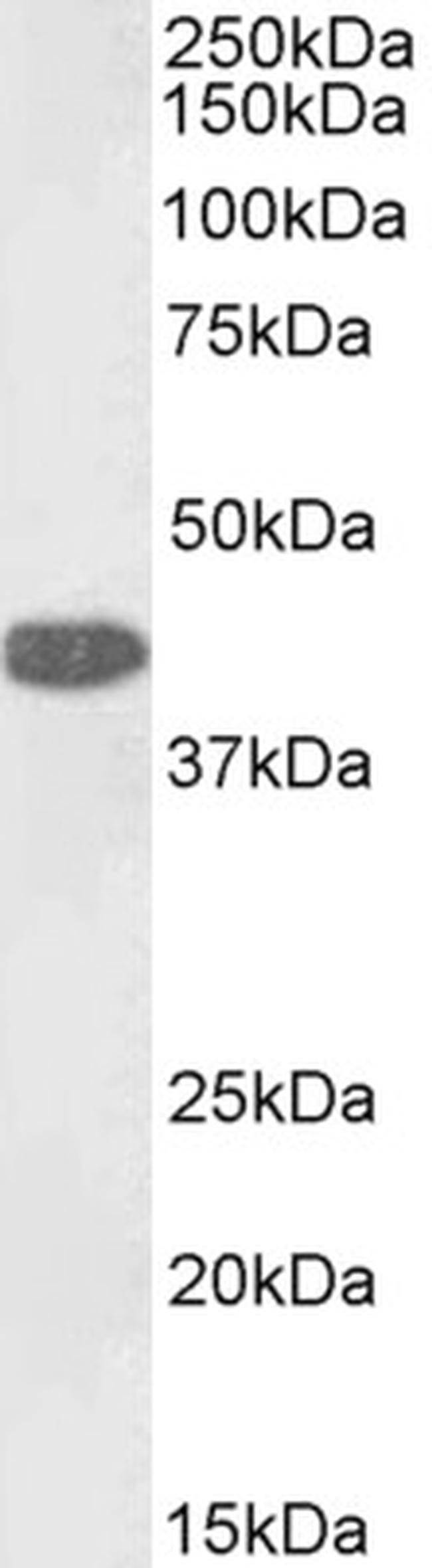 GOT1 Antibody in Western Blot (WB)