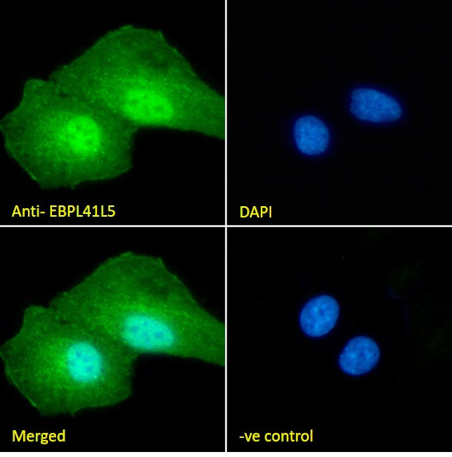 EPB41L5 Antibody in Immunocytochemistry (ICC/IF)