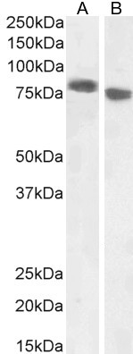 EPB41L5 Antibody in Western Blot (WB)