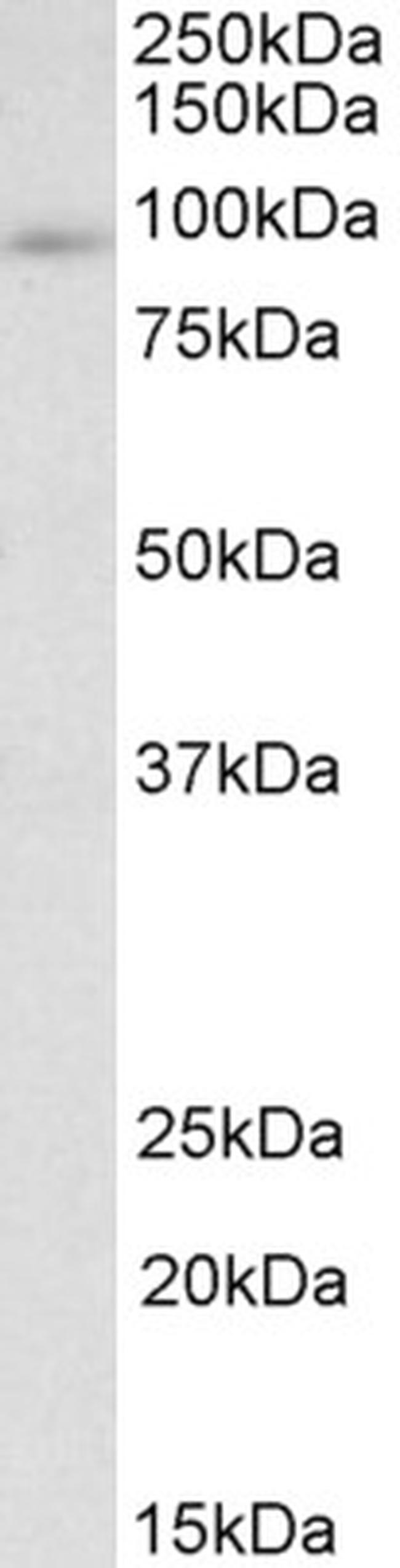 ADAP Antibody in Western Blot (WB)