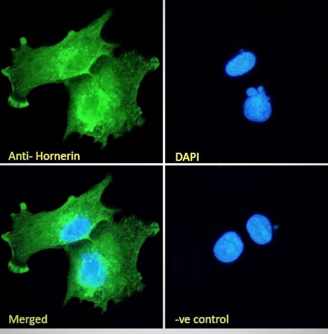 HRNR Antibody in Immunocytochemistry (ICC/IF)