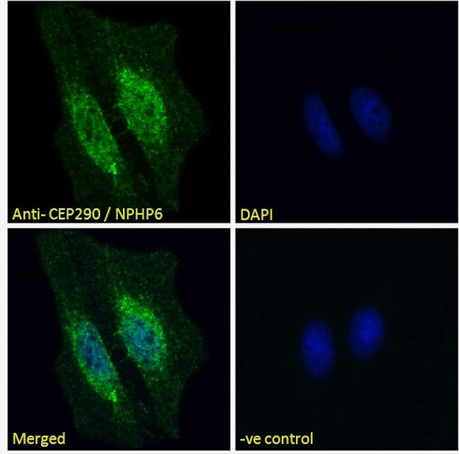 CEP290 Antibody in Immunocytochemistry (ICC/IF)