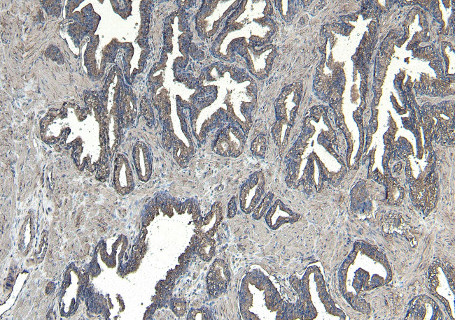 CEP290 Antibody in Immunohistochemistry (Paraffin) (IHC (P))