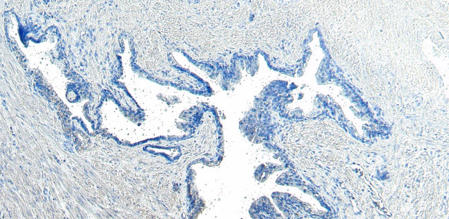 CEP290 Antibody in Immunohistochemistry (Paraffin) (IHC (P))