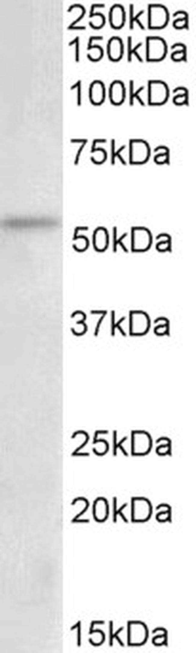 Chk1 Antibody in Western Blot (WB)