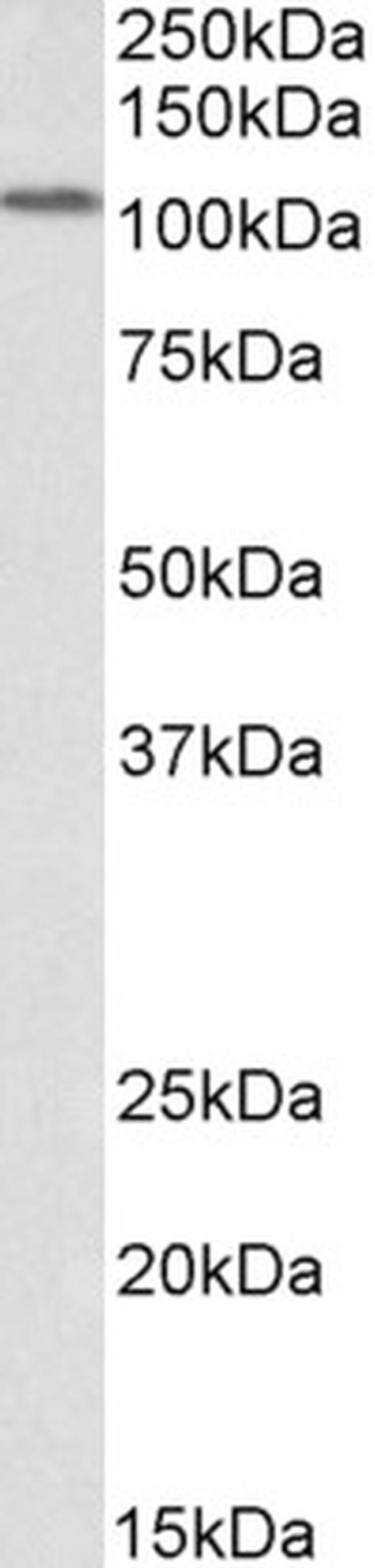 LSD1 Antibody in Western Blot (WB)