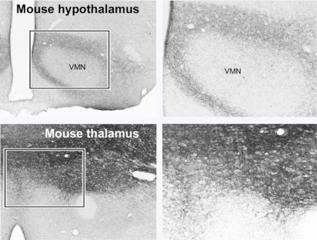 VGLUT1 Antibody in Immunohistochemistry (Paraffin) (IHC (P))