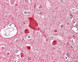 ABCA2 Antibody in Immunohistochemistry (Paraffin) (IHC (P))