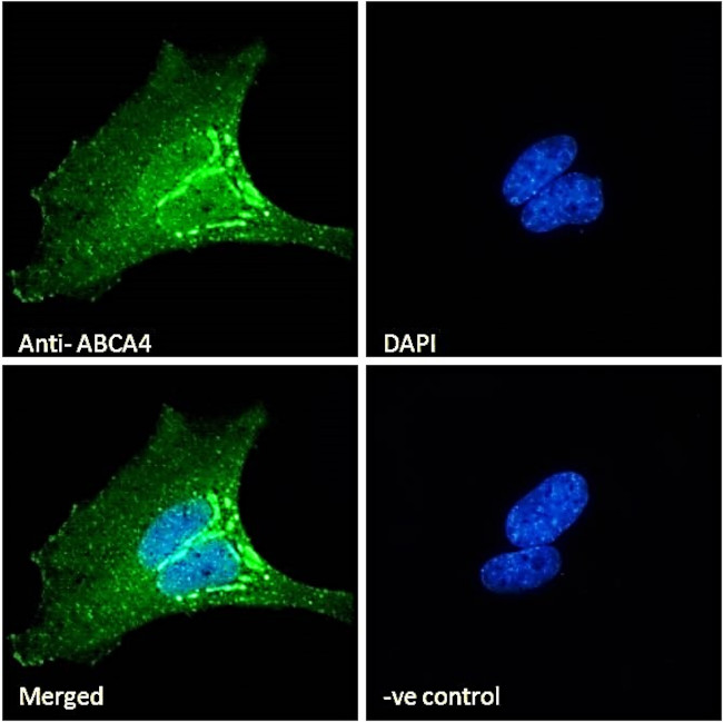 ABCA4 Antibody in Immunocytochemistry (ICC/IF)